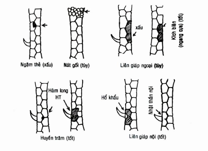 Liên Giáp Nội là gì?